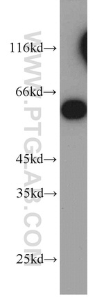 CCT3 Antibody in Western Blot (WB)