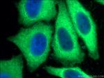 CCT3 Antibody in Immunocytochemistry (ICC/IF)