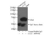 CCT3 Antibody in Immunoprecipitation (IP)