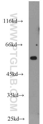 CCT3 Antibody in Western Blot (WB)