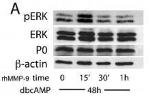 MPZ/P0 Antibody in Western Blot (WB)