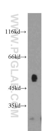 SUV39H1 Antibody in Western Blot (WB)