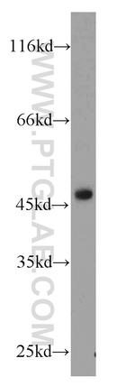 SUV39H1 Antibody in Western Blot (WB)