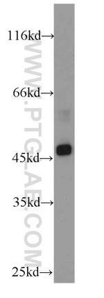 SUV39H1 Antibody in Western Blot (WB)