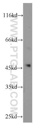 SUV39H1 Antibody in Western Blot (WB)