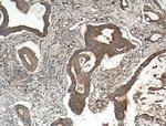 RKIP Antibody in Immunohistochemistry (Paraffin) (IHC (P))