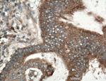 RKIP Antibody in Immunohistochemistry (Paraffin) (IHC (P))