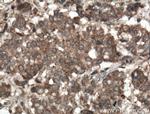 RKIP Antibody in Immunohistochemistry (Paraffin) (IHC (P))