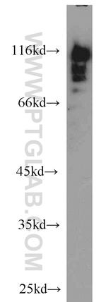 HNRNPUL1 Antibody in Western Blot (WB)