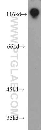 HNRNPUL1 Antibody in Western Blot (WB)