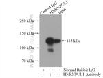 HNRNPUL1 Antibody in Immunoprecipitation (IP)