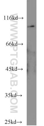 ERCC3 Antibody in Western Blot (WB)