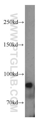 ERCC3 Antibody in Western Blot (WB)