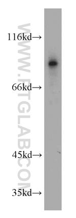 ERCC3 Antibody in Western Blot (WB)