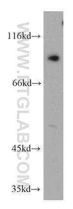 ERCC3 Antibody in Western Blot (WB)