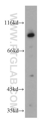 ERCC3 Antibody in Western Blot (WB)