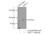 ERCC3 Antibody in Immunoprecipitation (IP)