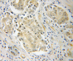 POT1 Antibody in Immunohistochemistry (Paraffin) (IHC (P))