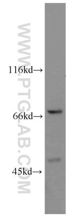 POT1 Antibody in Western Blot (WB)