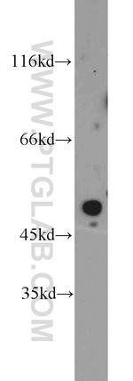 POT1 Antibody in Western Blot (WB)