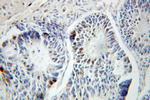 PELO Antibody in Immunohistochemistry (Paraffin) (IHC (P))