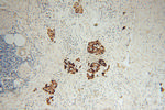 IA-2/PTPRN Antibody in Immunohistochemistry (Paraffin) (IHC (P))