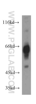 IA-2/PTPRN Antibody in Western Blot (WB)