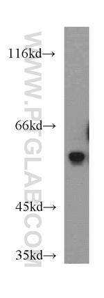 IA-2/PTPRN Antibody in Western Blot (WB)