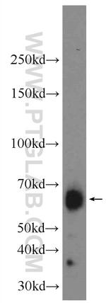 IA-2/PTPRN Antibody in Western Blot (WB)