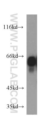 IA-2/PTPRN Antibody in Western Blot (WB)