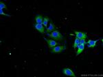 STMN2 Antibody in Immunocytochemistry (ICC/IF)