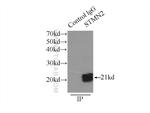 STMN2 Antibody in Immunoprecipitation (IP)