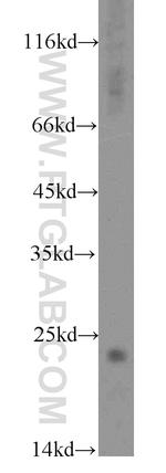 STMN2 Antibody in Western Blot (WB)