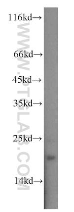 STMN2 Antibody in Western Blot (WB)