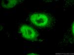 RBM15 Antibody in Immunocytochemistry (ICC/IF)