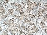 RBM15 Antibody in Immunohistochemistry (Paraffin) (IHC (P))