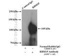 RBM15 Antibody in Immunoprecipitation (IP)