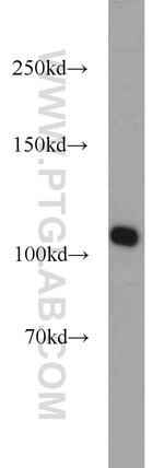 RBM15 Antibody in Western Blot (WB)