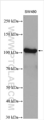 RBM15 Antibody in Western Blot (WB)