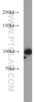 RBM15 Antibody in Western Blot (WB)