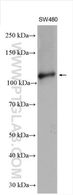 RBM15 Antibody in Western Blot (WB)