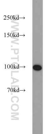 RBM15 Antibody in Western Blot (WB)