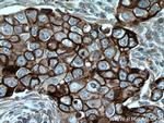 Cytokeratin 6A Antibody in Immunohistochemistry (Paraffin) (IHC (P))