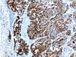 Cytokeratin 6A Antibody in Immunohistochemistry (Paraffin) (IHC (P))