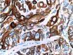 Cytokeratin 6A Antibody in Immunohistochemistry (Paraffin) (IHC (P))