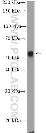 Cytokeratin 6A Antibody in Western Blot (WB)