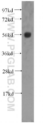 Cytokeratin 6A Antibody in Western Blot (WB)