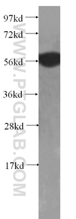 Cytokeratin 6A Antibody in Western Blot (WB)