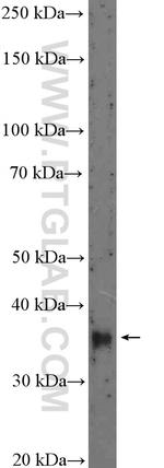 DLX5 Antibody in Western Blot (WB)