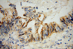 CD138/Syndecan-1 Antibody in Immunohistochemistry (Paraffin) (IHC (P))